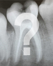 image of a tooth with a question mark on it